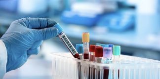 Testet e antitrupave/ OBSH shuan shpresën e Britanisë së Madhe!