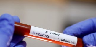 COVID-19 – Irani pranë shifrës së 5 000 viktimave