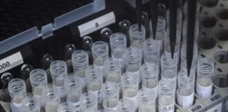 Shkencëtarët e Oksfordit rrisin shpresat: Vaksina e koronavirusit mund të jetë gati në shtator