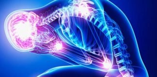 Çfarë duhet të bëni për dhimbjen e kyçeve