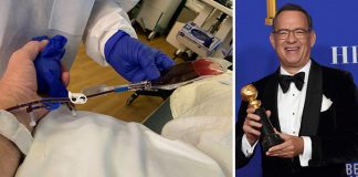 Tom Hanks shërohet nga COVID-19 dhe dhuron gjak për gjetjen e antitrupave