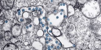 Instituti i Virologjisë i Wuhanit dyshohet për përhapjen e sëmundjes