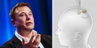 Elon Musk nuk heq dorë, do të nisë transplantimin e çipeve në trurin e njeriut brenda vitit 2022