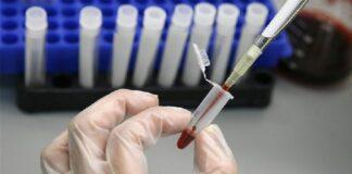 COVID-19/ Ministria e Shëndetësisë: 47 qytetarë të infektuar