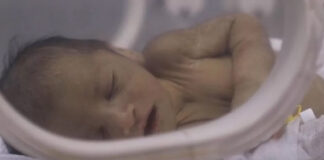 Mrekullia kur nxirresh dy herë i gjallë nga rrënojat