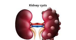 Ushqimet që duhet të hani, për të pasur veshka të shëndetshme