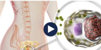 Shtohen sëmundjet SST! Mjekët: Janë shtuar rastet tek të rinjtë, nuk mbrohen