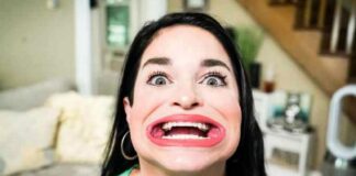 Është shpallur si gruaja me gojën më të madhe në botë, Samantha: Më bullizojnë…