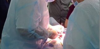 E rrallë në Selanik! 14-vjeçares me sindromën “Rapunzel” i hiqen nga stomaku 700 gramë flokë