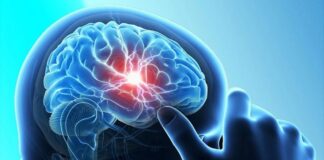 Gjashtë vitamina dhe suplemente që mund të parandalojnë tumoret e trurit