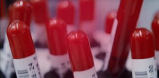 Platformë online për dhurimin e gjakut, Rama: Të forcojmë zinxhirin e solidaritetit