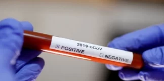 SHBA/ Teste falas për Covid për të parandaluar valën e dimrit