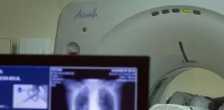 Studimi i ri: “COVID-i i gjatë” mund të shkaktojë anomali në organet kryesore