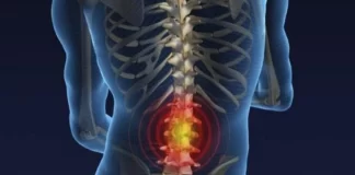 Spondiloartriti, sëmundja që prek nyjat e shtyllës kurrizore