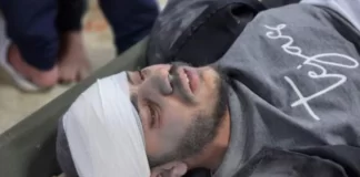 Situata në Gaza, mjeku: Po operojmë njerëz të shtrirë në tokë, është katastrofa e shekullit