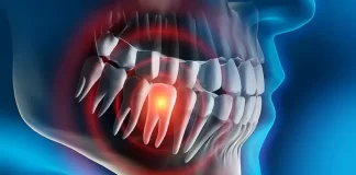 Nëntë mënyra si të trajtoni dhimbjen e dhëmbit gjatë natës