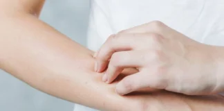 Si të mbroheni prej alergjisë nga dielli, përse duhet të nisni që tani