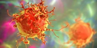 Zbulohet një shënues i ri për të identifikuar rrezikun e përsëritjes së kancerit të stomakut