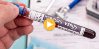 Çfarë është virusi vdekjeprurës Marburg që po përhapet në Afrikë dhe sa e rrezikuar është Evropa? Ende nuk ka një vaksinë
