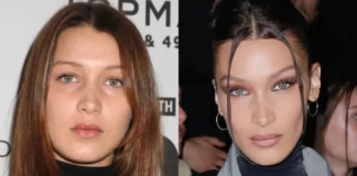 FOTO/ Operacionet plastike i ndryshuan jetën, si dukej Bella Hadidi përpara se të shpallej një nga vajzat më të bukura në botë