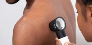 Shpiket pajisja që zbulon kancerin e lëkurës, ja si do të funksionojë