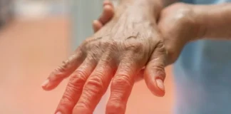 Artriti reumatoid, ushqimet që duhet të evitoni!