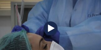 A duhet licensuar botoksi në Shqipëri?! Mjekët shpjegojnë mënyrat e përdorimit të tij: Jo vetëm për arsye estetike