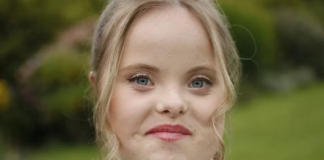 Modelja me sindromën Down që synon të ndryshojë pikëpamjen e industrisë së modës