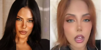 Modelja e diagnostikuar si ‘sociopate’ këshillon ndjekësit në rrjet si të dallojnë personat si ajo (fotot)