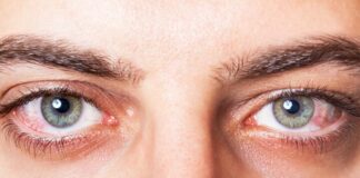 6 këshilla si të përmirësoni shikimin e mprehtë dhe shëndetin e syve