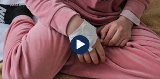 Grip i vështirë për të miturit/ Korçë, çdo ditë 60 raste që kërkojnë ndihmë pranë mjekëve, disa me komplikacione