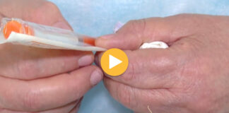 Injeksion falas për të shpëtuar sytë/ Pacientët me diabet të prekur nga retinopatia përfitojnë trajtimin që i mbron nga verbimi