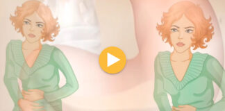 Refluksi i stomakut, mjekët: Kujdes jo vetëm me ushqimin, por edhe nga ilaçet që përdoren