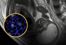 Shkenca: Qelizat e nënës qëndrojnë në trupin tonë gjatë gjithë jetës