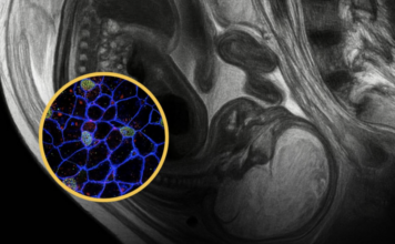 Shkenca: Qelizat e nënës qëndrojnë në trupin tonë gjatë gjithë jetës