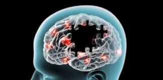 Pse terapia nuk funksionon njësoj për të gjithë pacientët me parkinson?